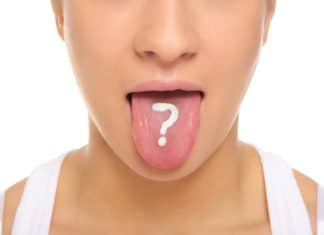 Es gibt viele verschiedene Arten von Pickeln auf der Zunge.