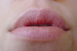 Lippen