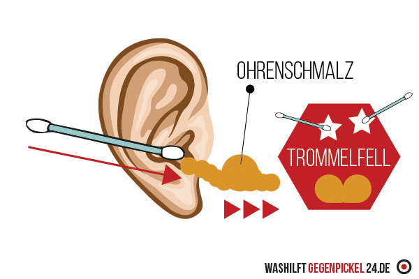 Pickel im Ohr - Was man vermeiden sollte